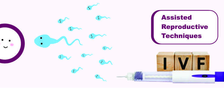 Assisted Reproductive Techniques