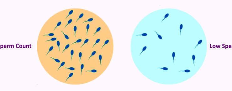 Comprehensive Evaluation of Infertile Male