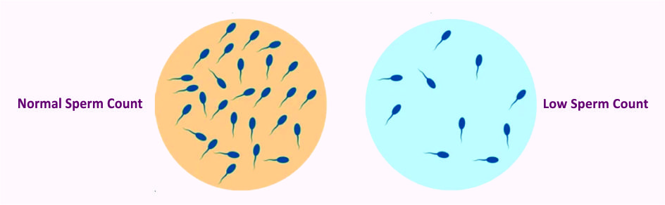 Comprehensive Evaluation of Infertile Male