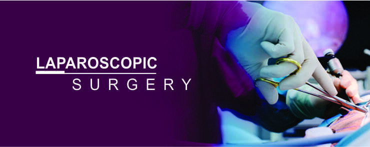 Laparoscopy