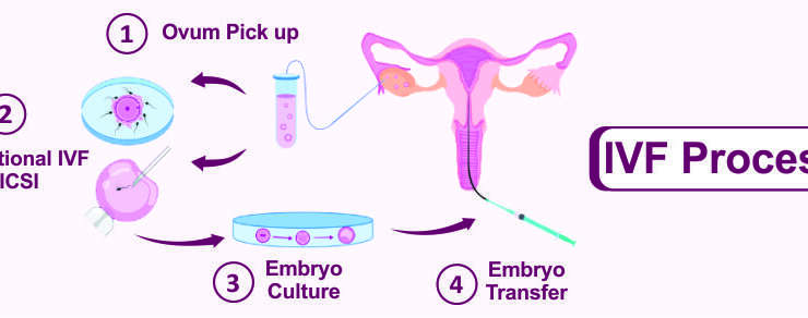 Best IVF Center in Delhi