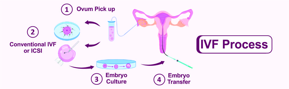 Best IVF Center in Delhi