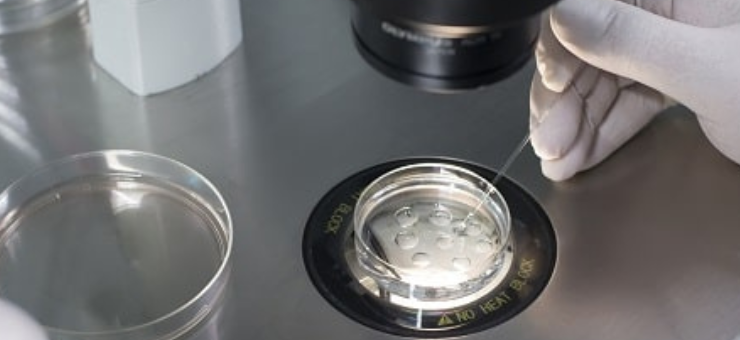 Add Ons To IVF Success