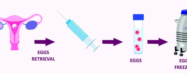 Cryopreservation/Freezing/Vitrification