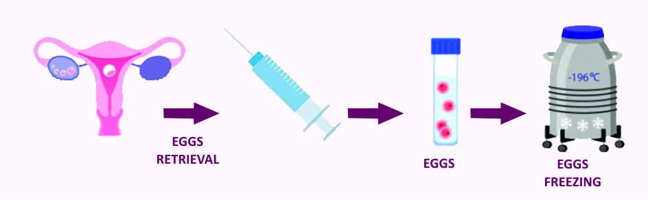 Cryopreservation/Freezing/Vitrification
