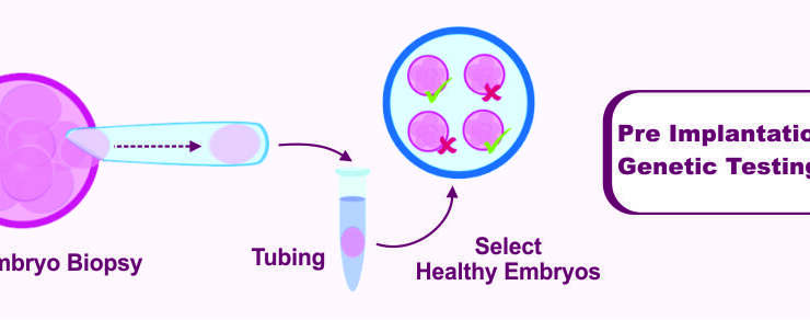 Pre Implantation Genetic Testing (PGT)