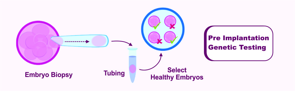 Pre Implantation Genetic Testing (PGT)