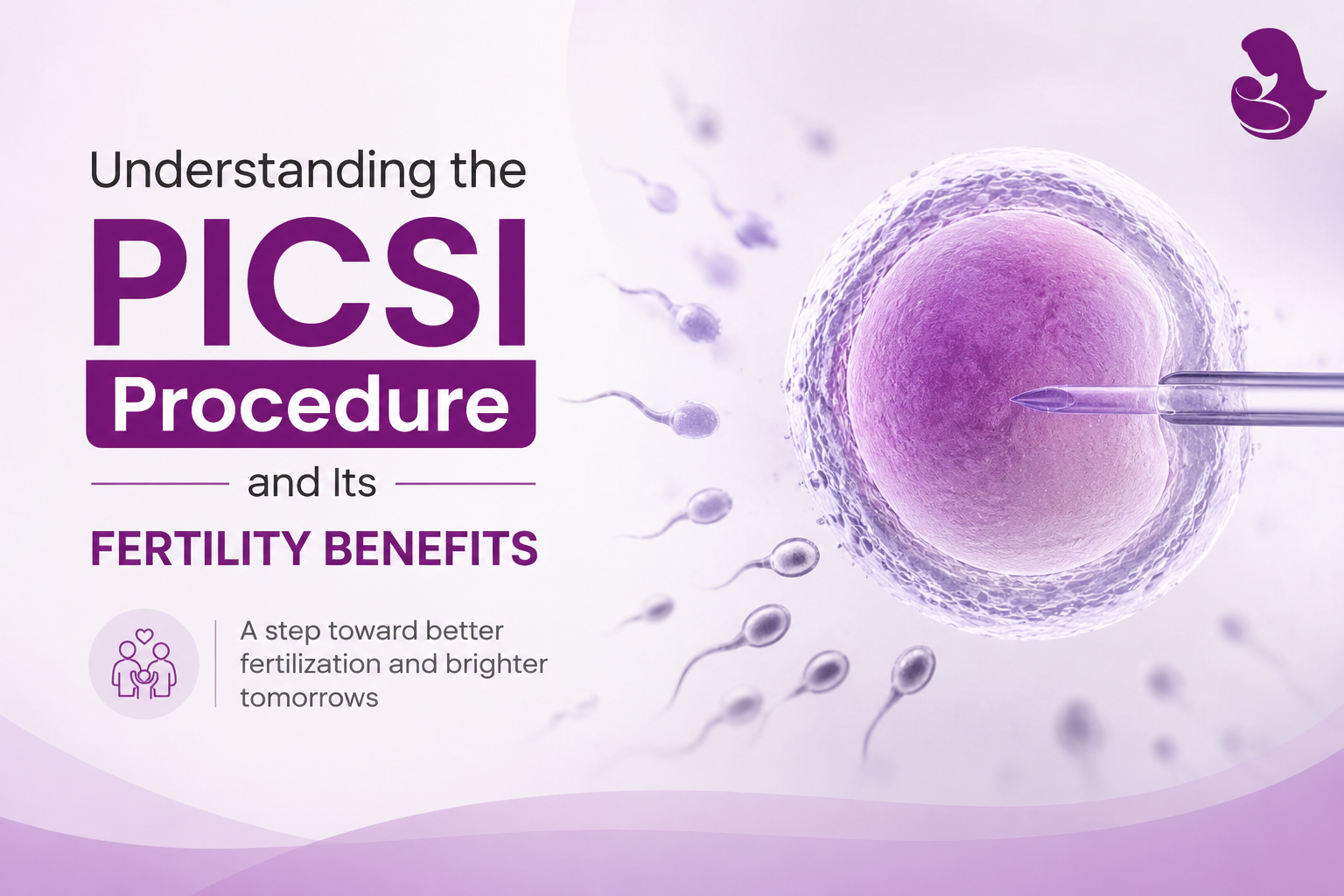 Understanding the PICSI Procedure and Its Fertility Benefits