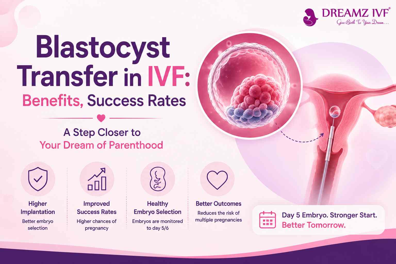 Blastocyst Transfer in IVF: Benefits, Success Rates